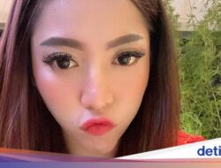 Alasan Monica Indah Ngaku Karena Itu Korban Filler Payudara Ilegal