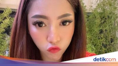 Alasan Monica Indah Ngaku Karena Itu Korban Filler Payudara Ilegal