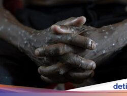 Makin Melonjak! Peristiwa Pidana Mpox Ke Afrika Nyaris Tembus 30 Ribu Peristiwa Pidana