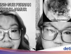 Ramai Kisah Wanita Punya Jamur Di Kuping Berbulan-bulan, Inikah Pemicunya?